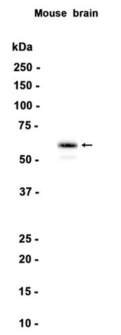 STXBP1 (6W16) Rabbit Monoclonal Antibody