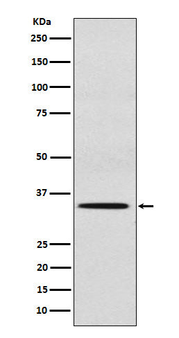 SULT2A1 (5Q7) Rabbit Monoclonal Antibody