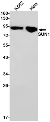 SUN1 (17J11) Rabbit Monoclonal Antibody