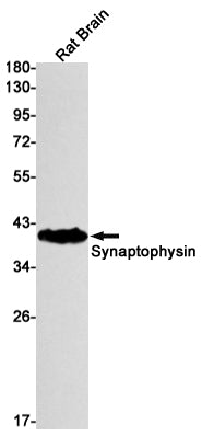 Synaptophysin  (10B17) Rabbit Monoclonal Antibody