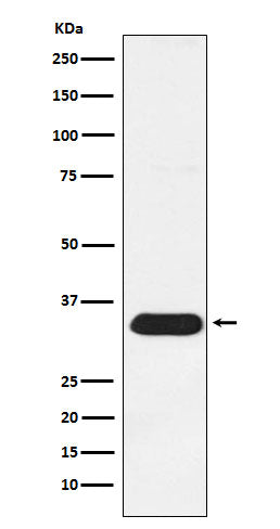 Syntenin (7V6) Rabbit Monoclonal Antibody