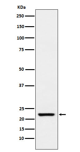 TAGLN (17E19) Rabbit Monoclonal Antibody