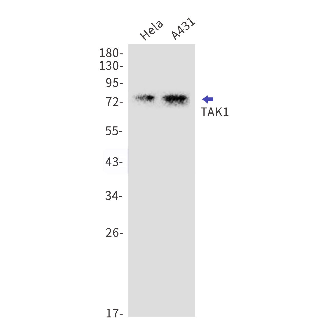 TAK1 (13O7) Rabbit Monoclonal Antibody