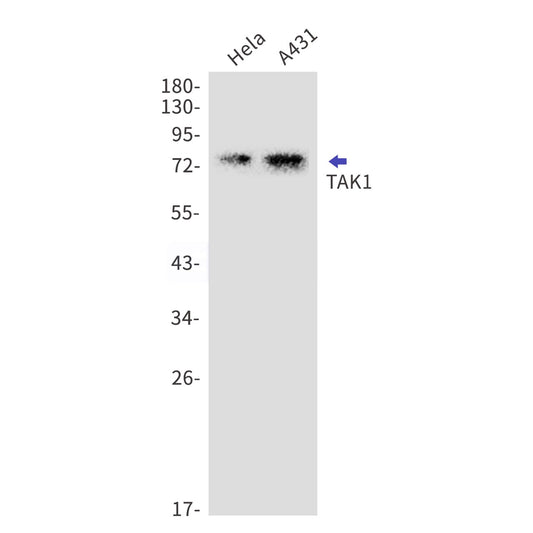 TAK1 (13O7) Rabbit Monoclonal Antibody