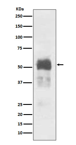 Tau (5W5) Rabbit Monoclonal Antibody