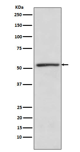 TBLR1 (6N18) Rabbit Monoclonal Antibody