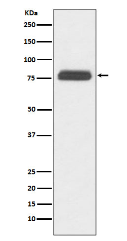 TBR1 (3X17) Rabbit Monoclonal Antibody