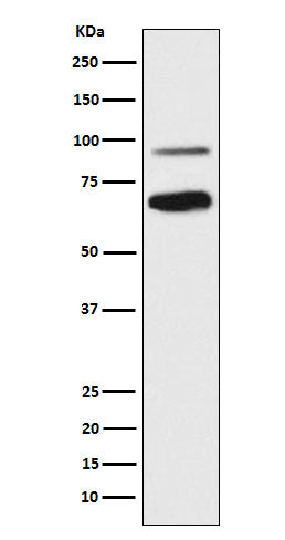 TCF4 (14L3) Rabbit Monoclonal Antibody