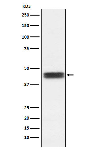 TFPI (11K2) Rabbit Monoclonal Antibody