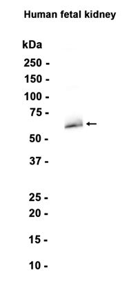 TGFBI (10L15) Rabbit Monoclonal Antibody