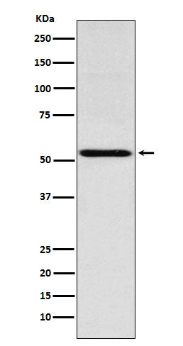 THRA (5Z6) Rabbit Monoclonal Antibody