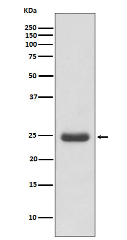 Thymidine Kinase 1 (8E14) Rabbit Monoclonal Antibody