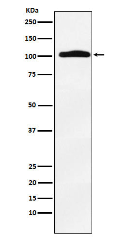 Thyroid Peroxidase (18B1) Rabbit Monoclonal Antibody