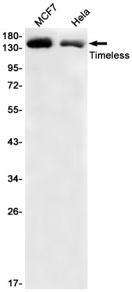 Timeless (9L9) Rabbit Monoclonal Antibody