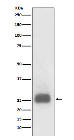 TIMP1 (1S3) Rabbit Monoclonal Antibody
