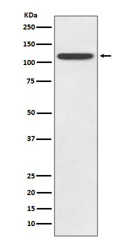 TLR5 (13A4) Rabbit Monoclonal Antibody