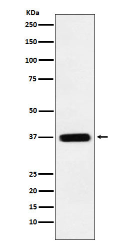 TMEM173 (3U7) Rabbit Monoclonal Antibody