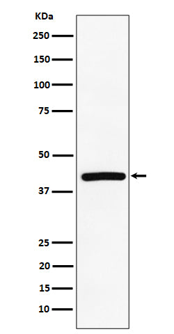 TMEM43 (2M3) Rabbit Monoclonal Antibody