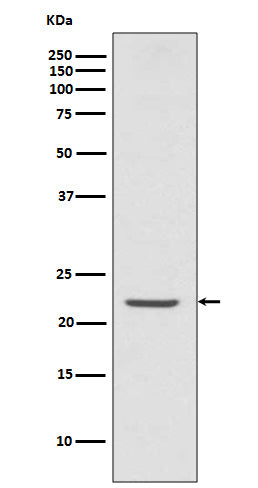 TMS1 (2N17) Rabbit Monoclonal Antibody