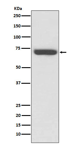 TNF Receptor II (19A16) Rabbit Monoclonal Antibody