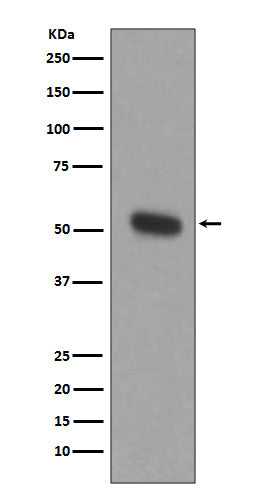 TPH1 (16G2) Rabbit Monoclonal Antibody