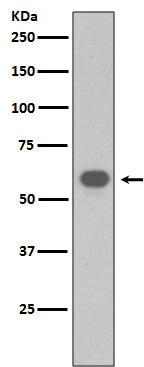 TRAF6 (6S7) Rabbit Monoclonal Antibody
