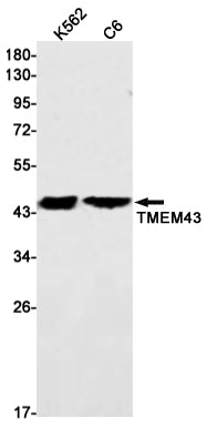 Transmembrane Protein 43 (9N13) Rabbit Monoclonal Antibody