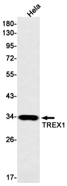 TREX1 (1U7) Rabbit Monoclonal Antibody