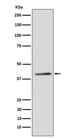 TRIB3 (4E15) Rabbit Monoclonal Antibody
