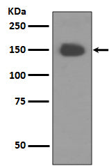 TrkA (14C16) Rabbit Monoclonal Antibody