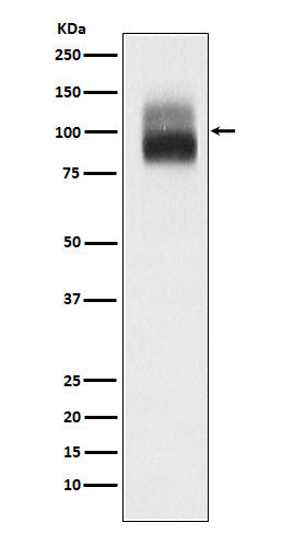 TrkB (3K17) Rabbit Monoclonal Antibody