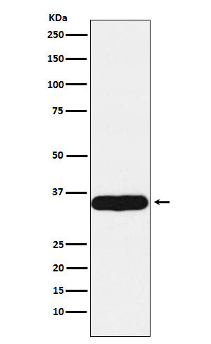 Tropomyosin 1 (9X18) Rabbit Monoclonal Antibody