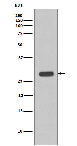 Troponin I (14Z15) Rabbit Monoclonal Antibody