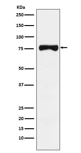 TRP1 (8L13) Rabbit Monoclonal Antibody
