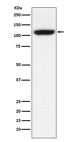 TRPM8  (8F1) Rabbit Monoclonal Antibody