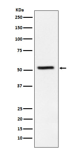 TrpRS (12Y1) Rabbit Monoclonal Antibody