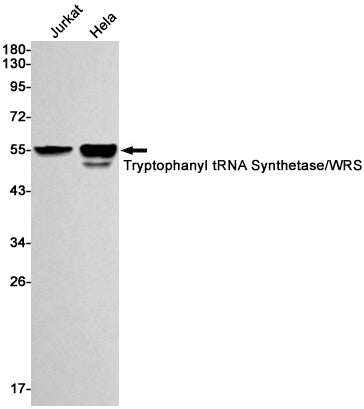 Tryptophanyl tRNA synthetase (7L16) Rabbit Monoclonal Antibody