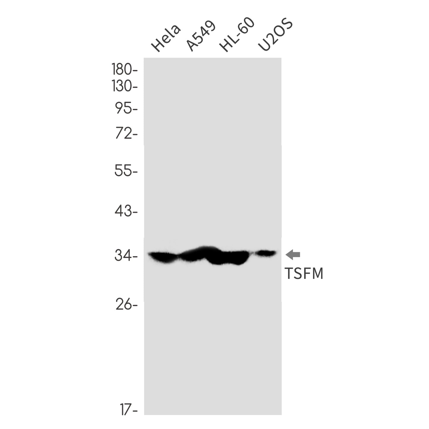 TSFM (9P10) Rabbit Monoclonal Antibody