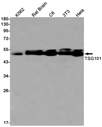 TSG101 (10N13) Rabbit Monoclonal Antibody