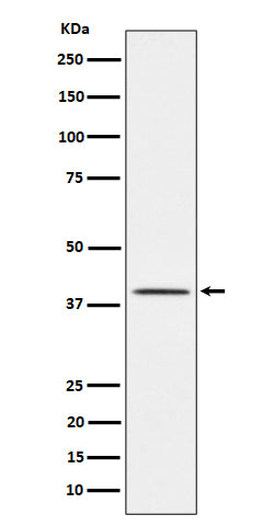 TTF1 (11V4) Rabbit Monoclonal Antibody