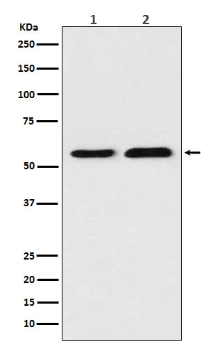 TXNRD1 (6I18) Rabbit Monoclonal Antibody