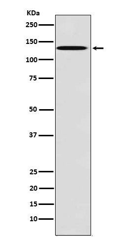 TYRO3 (5G16) Rabbit Monoclonal Antibody