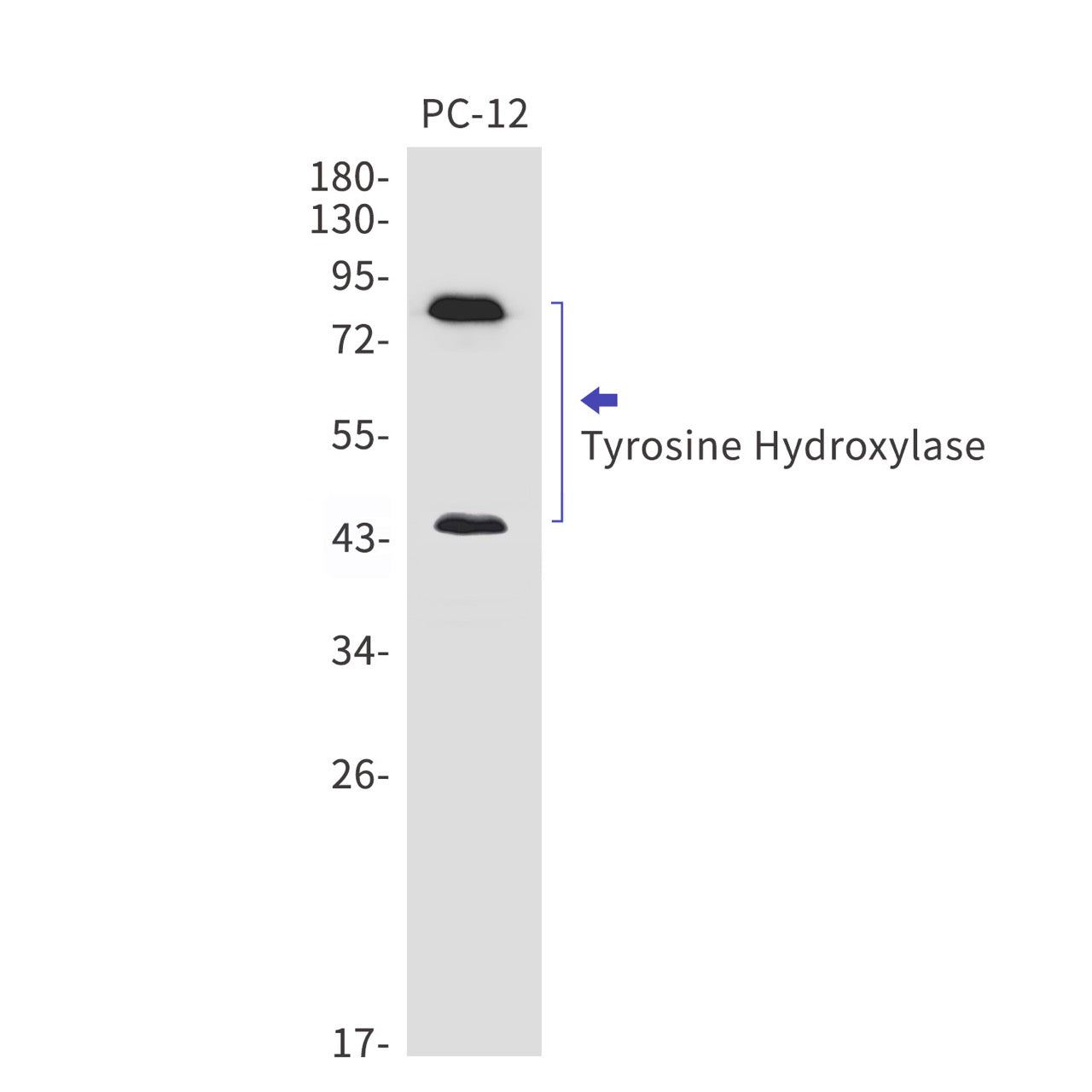 Tyrosine Hydroxylase (14U19) Rabbit Monoclonal Antibody