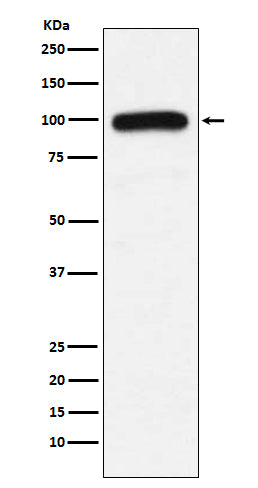 UBE3A (15N18) Rabbit Monoclonal Antibody