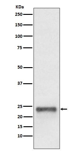 Ubiquitin D (18O15) Rabbit Monoclonal Antibody