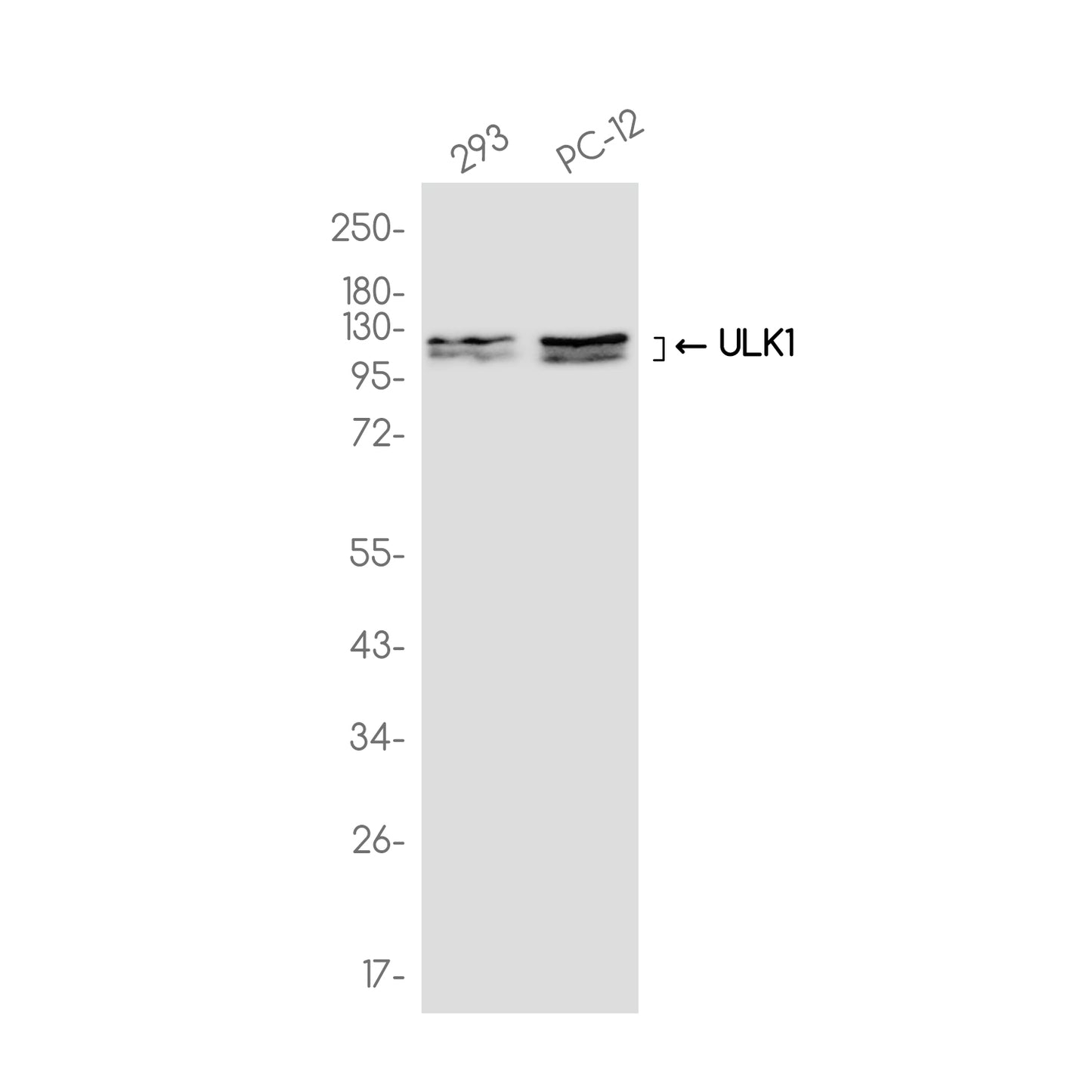 ULK1 (3G10) Rabbit Monoclonal Antibody