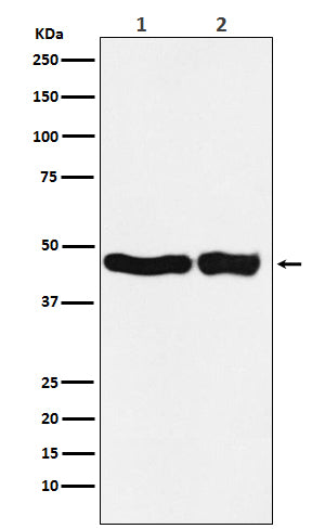 UQCRC2  (11W16) Rabbit Monoclonal Antibody