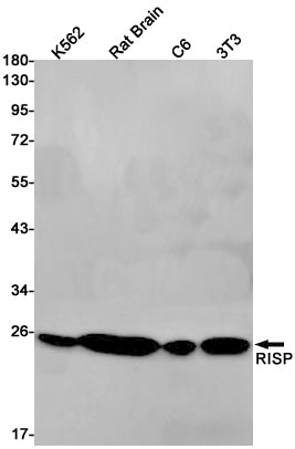 UQCRFS1 (3O14) Rabbit Monoclonal Antibody