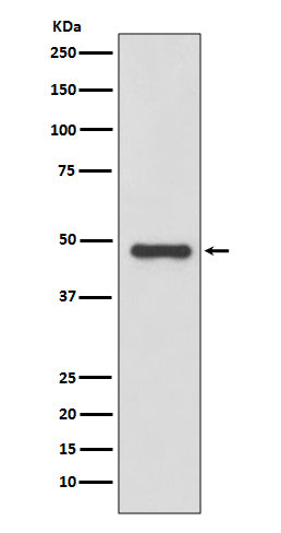 Urokinase (4A13) Rabbit Monoclonal Antibody