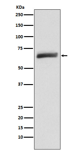 USP22  (14R2) Rabbit Monoclonal Antibody